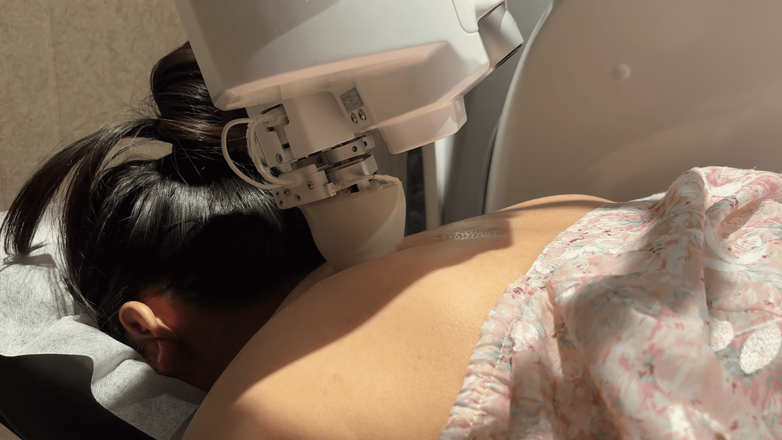 Patient receiving AI-powered robotic Tuina massage on upper back using EMMA TCM massage robot